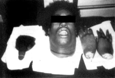 Dahmer was held. . Jeffrey dahmer rib cage polaroid photo